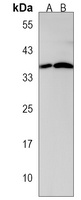 CTDSPL Antibody
