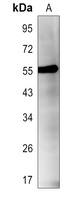 RIPK3 (Phospho-S227) Antibody