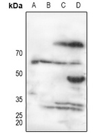 Alpha 1B glycoprotein Rabbit Polyclonal Antibody