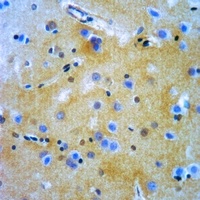 Anti-Alpha 1B glycoprotein Antibody