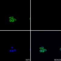 Anti-Alpha 1B glycoprotein Antibody
