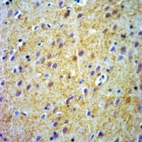 ABCB7 antibody