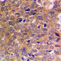 Anti-ABL1/2 (Phospho-Y393/439) Antibody