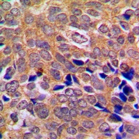 ABL1 antibody