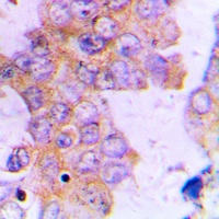 Anti-ACAT1 Antibody