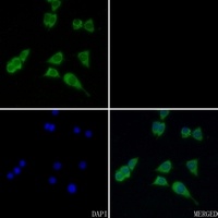 Anti-ACAT1 Antibody