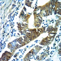 Anti-Acetylcholinesterase Antibody