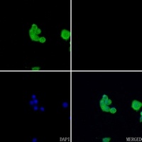 ACHE antibody