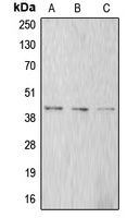 Alpha-actin-1 Rabbit Polyclonal Antibody