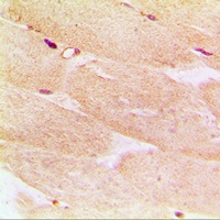 Alpha-actin-1 Rabbit Polyclonal Antibody