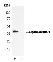 ACTA1 antibody