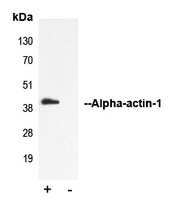 Alpha-actin-1 Rabbit Polyclonal Antibody