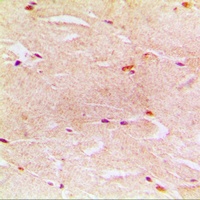 Anti-Alpha-actin-3 Antibody
