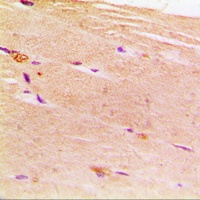 ACTN2 antibody