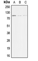 ACTN3 Rabbit Polyclonal Antibody