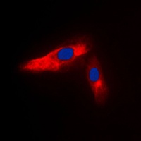 Anti-ACTN3 Antibody