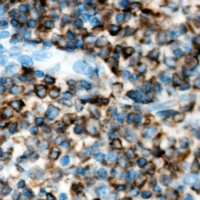 Anti-ACVR1B Antibody