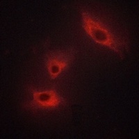Anti-ACVR1B Antibody