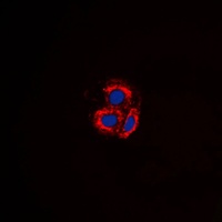 ACVRL1 antibody