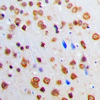 Anti-ADAR2 Antibody