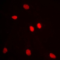Anti-ADAR2 Antibody