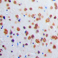 Anti-Adenylate Cyclase 1 Antibody
