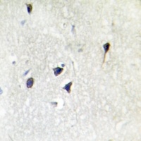 Anti-Adenylate Cyclase 5/6 Antibody