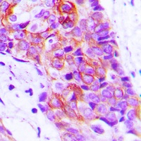 Anti-Adenylate Cyclase 9 Antibody