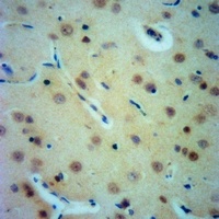 Anti-Gamma-adducin Antibody