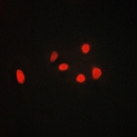 Anti-Gamma-adducin Antibody