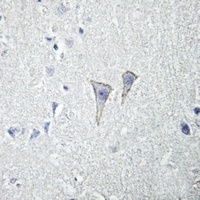Anti-Adenosine A2a Receptor Antibody