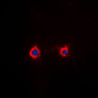 Anti-Adenosine A2a Receptor Antibody