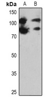 PARP1 Antibody