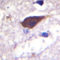 Anti-Beta-2 Adrenergic Receptor (Phospho-S346) Antibody