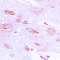 Anti-GRK2 (Phospho-S29) Antibody