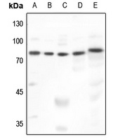 GRK2 Antibody [KO/KD Validated]