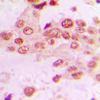 Anti-GRK2 Antibody