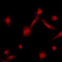 Anti-GRK2 Antibody