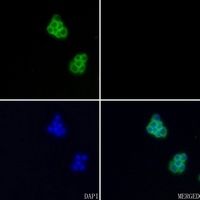 Anti-Aggrecan Antibody