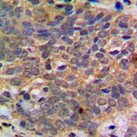 Anti-AKT (Phospho-S473) Antibody