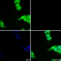 Anti-AKT (Phospho-S473) Antibody