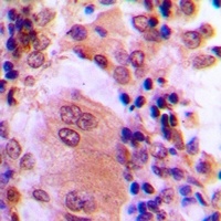 Anti-AKT (Phospho-T308) Antibody