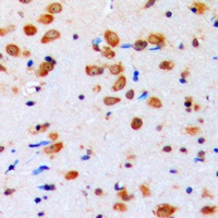 Anti-AKT (Phospho-Y315) Antibody