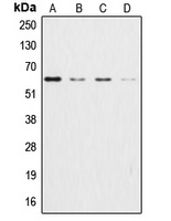 AKT Antibody