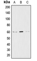 AKT Rabbit Polyclonal Antibody