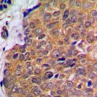AKT Rabbit Polyclonal Antibody