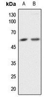AKT Antibody