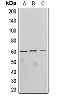 AKT Rabbit Polyclonal Antibody
