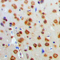 AKT Rabbit Polyclonal Antibody