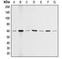 AKT Antibody